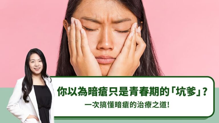 你以為暗瘡只是青春期的「坑爹」？一次搞懂暗瘡的治療之道！