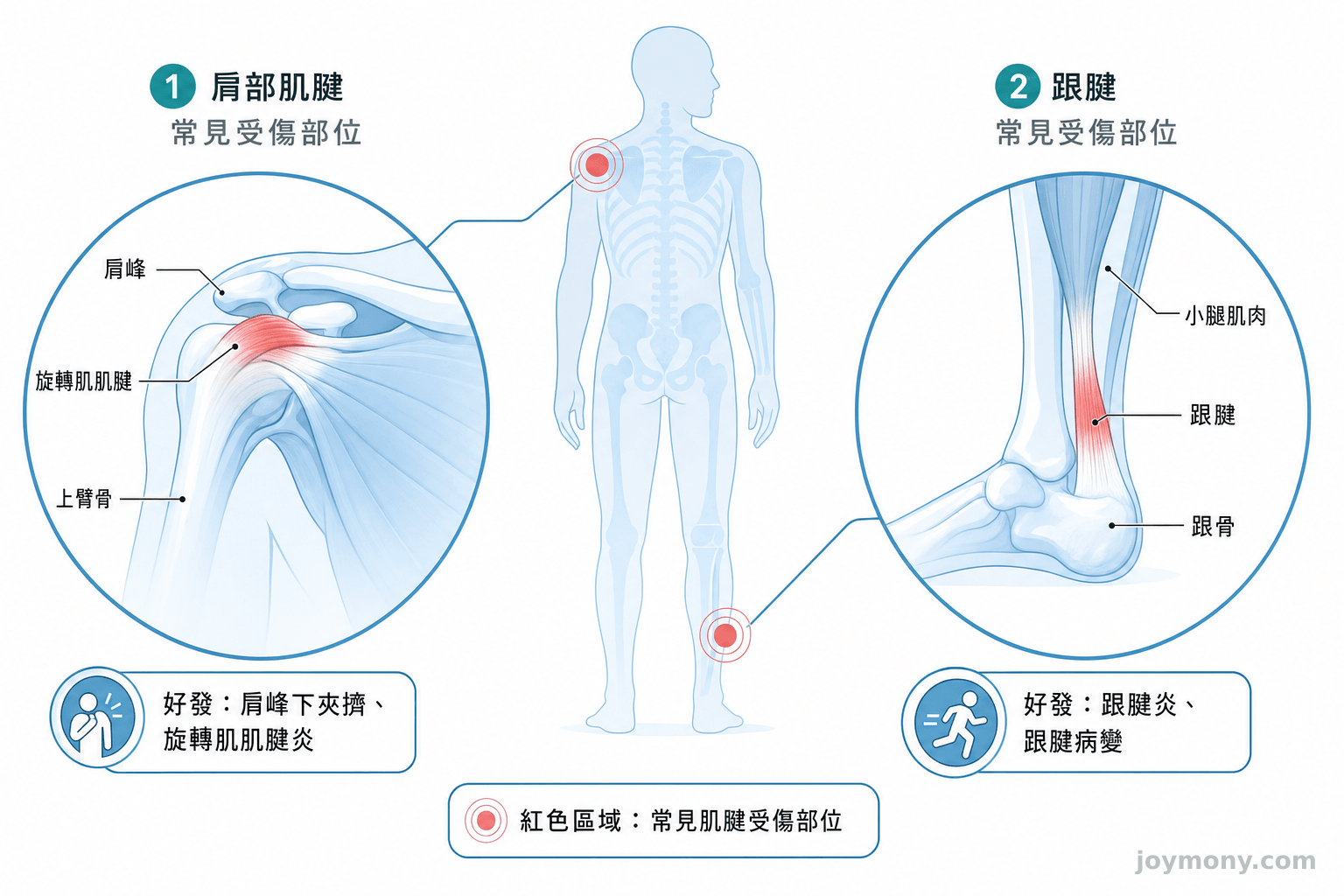Hyaluronic Acid vs PRP for Tendons