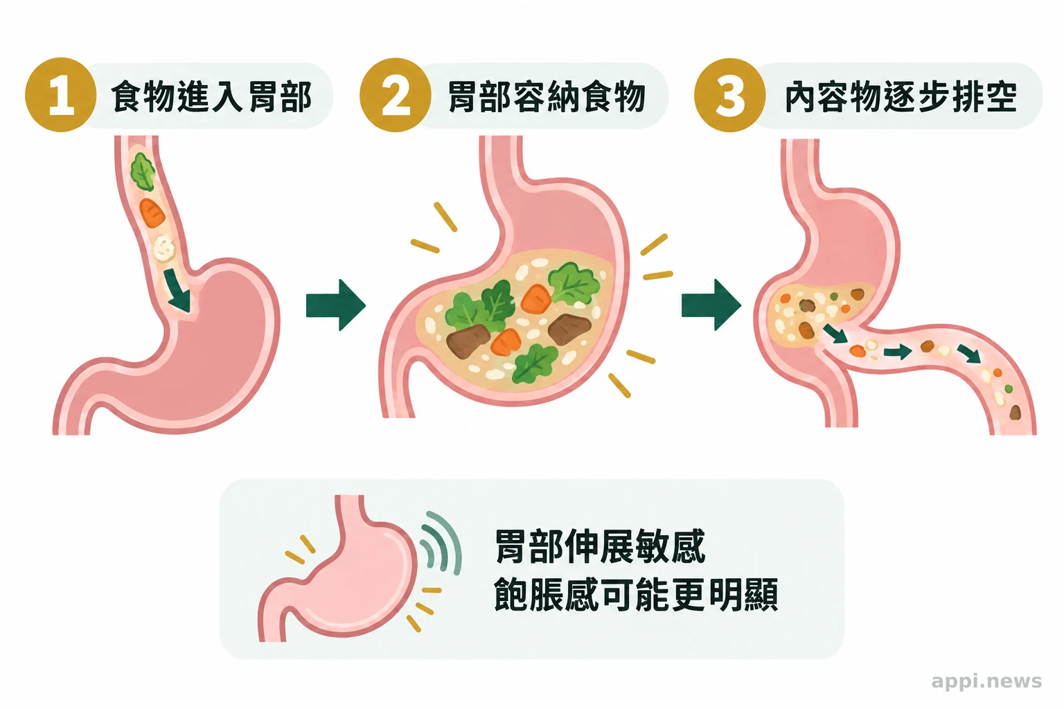 胃部容納餐後食物並逐步將內容物送往小腸，旁示胃部伸展敏感度可能影響飽脹感。
