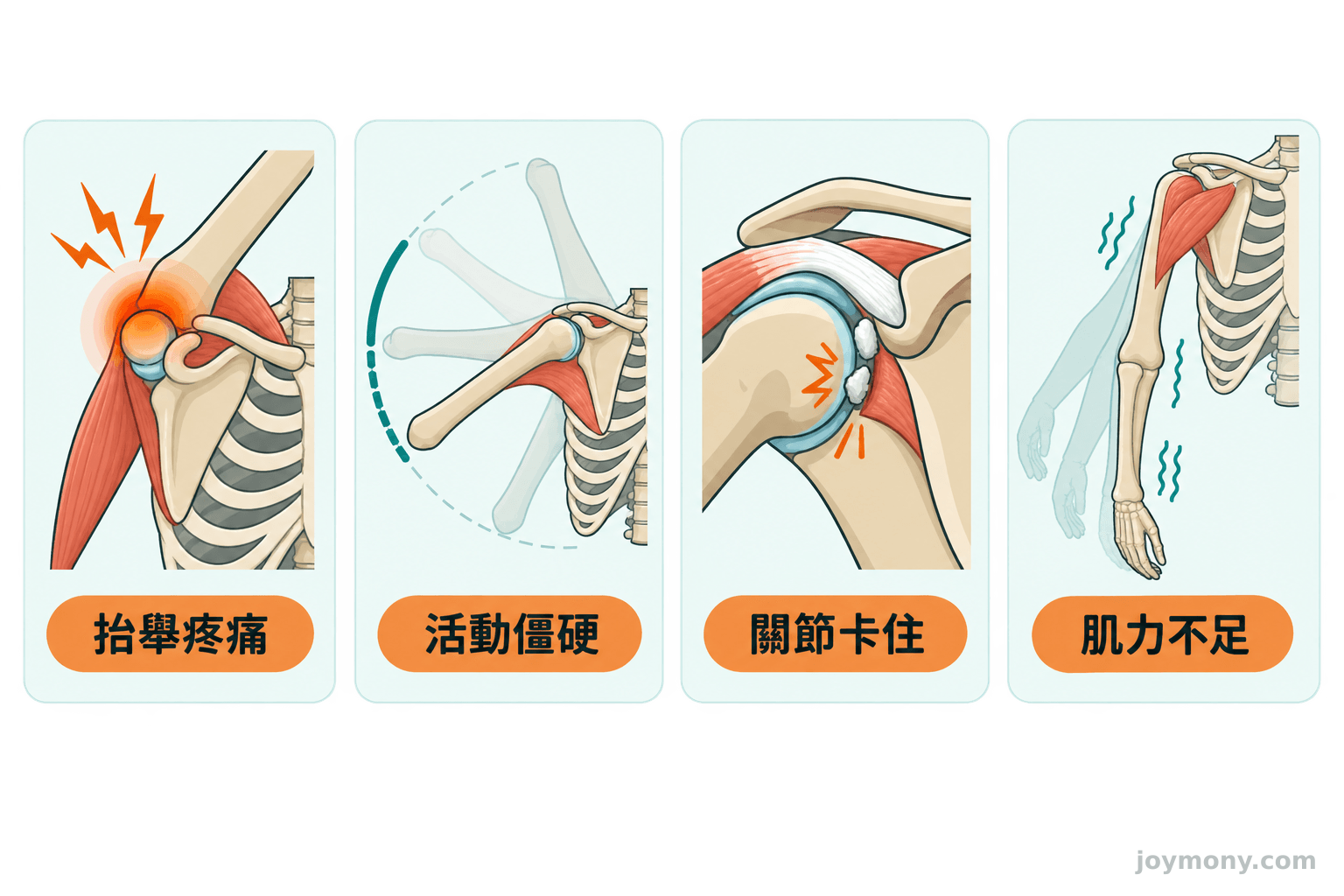 肩膀抬不起來時疼痛、僵硬、卡住與無力的不同表現示意圖