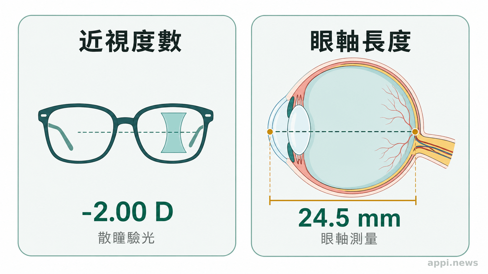 近視度數與眼軸長度屬於不同追蹤指標的比較示意