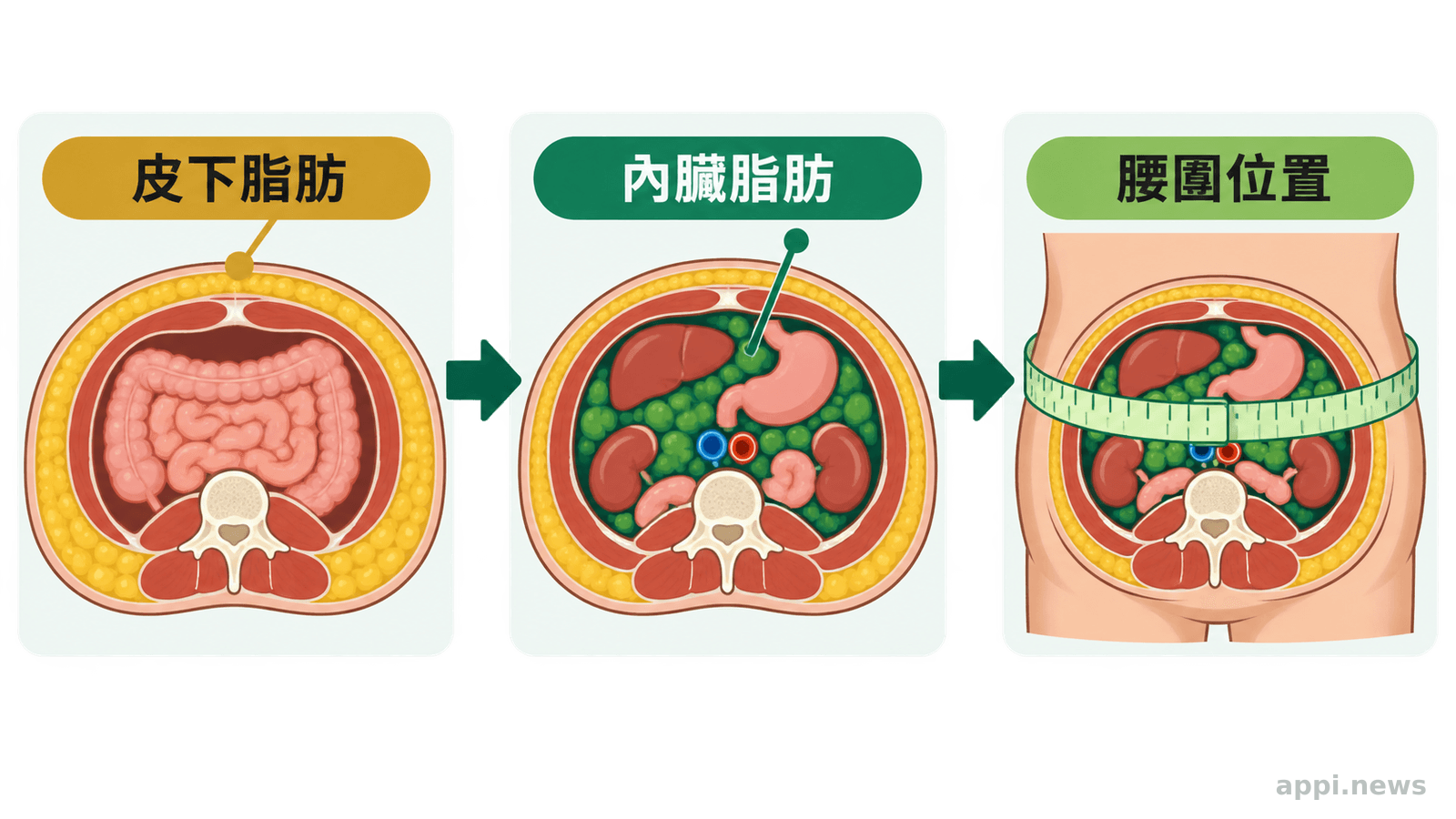 皮下脂肪、內臟脂肪與腰圍測量位置比較示意圖
